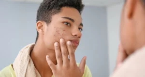 Mon visage est ravagé par de l’acné!