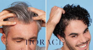 HORACE LANCE SON SÉRUM ANTI-CHUTE DE CHEVEUX